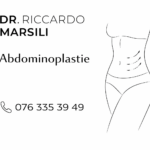 Tout savoir sur l&rsquo;abdominoplastie à Lausanne