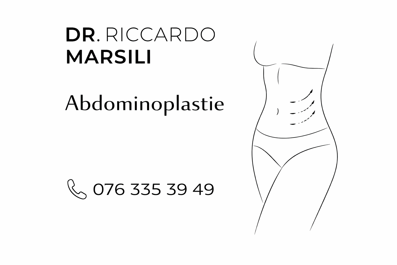 Tout savoir sur l&rsquo;abdominoplastie à Lausanne